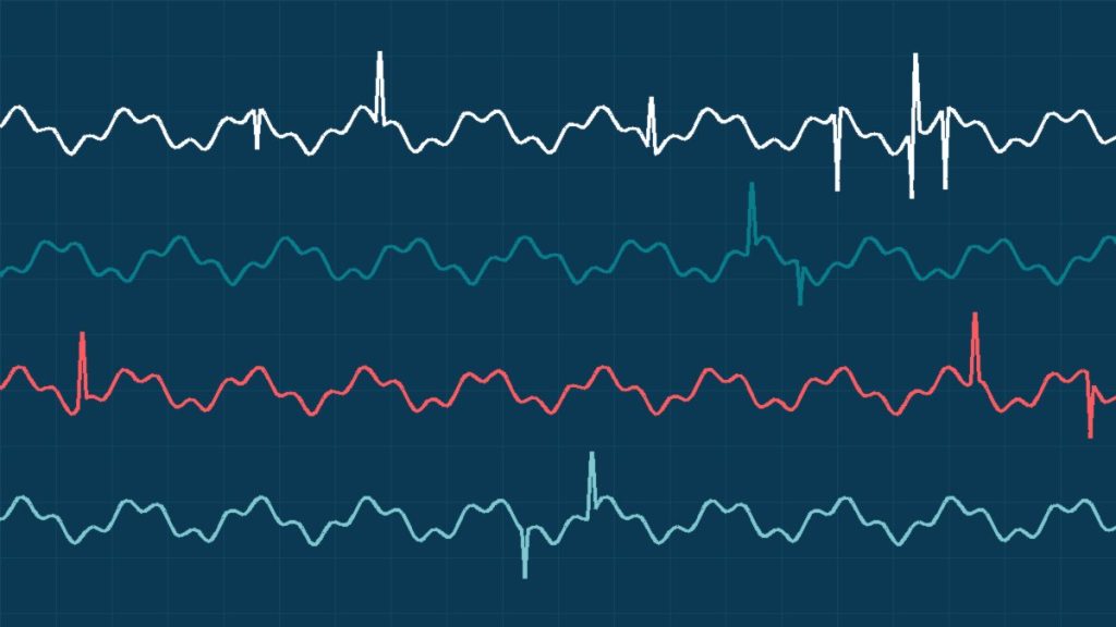 EEG ve EMG Hakkında Sıkça Sorulan Sorular