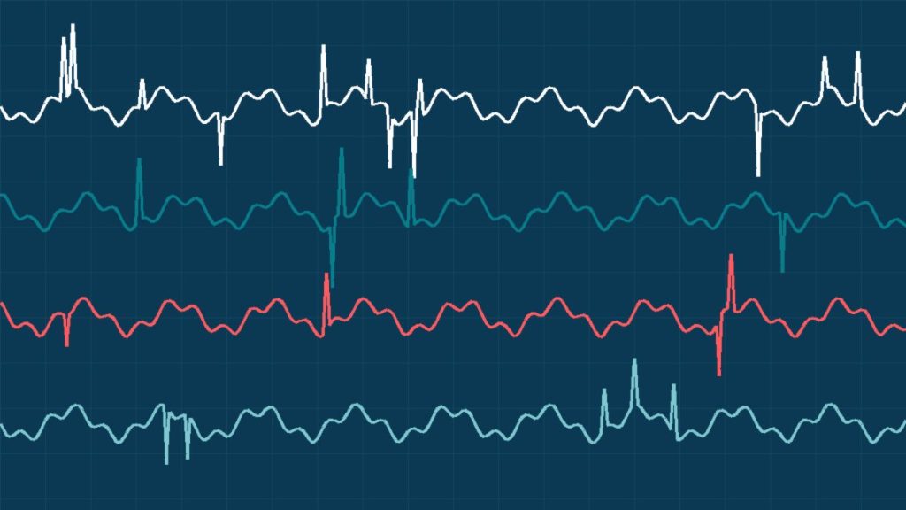 EEG Nedir? Beyin Dalgaları Testi Hakkında Her Şey