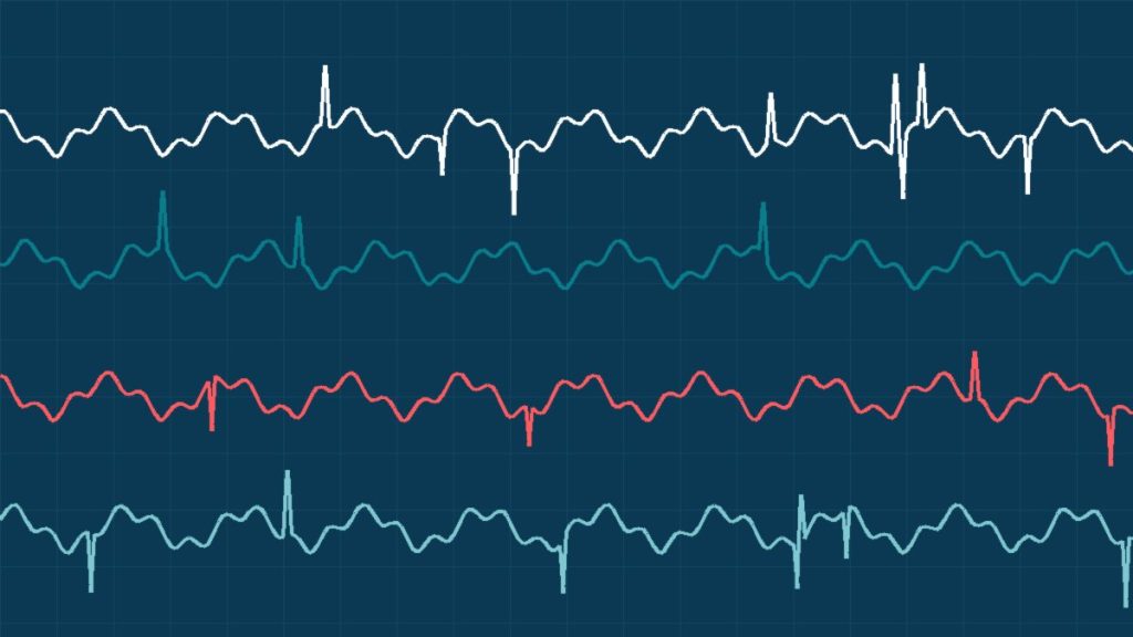 İğneli EMG: Nasıl Yapılır, Acıtır mı?